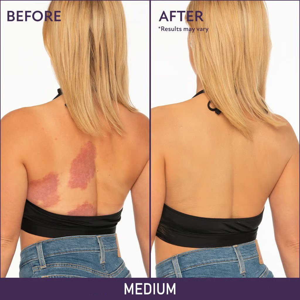 🎁Sista dagen på rea 49 % rabatt🔥-✨Mjuk matt krämconcealer