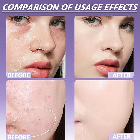 🎁Sista dagen på rea 49 % rabatt🔥-✨Mjuk matt krämconcealer